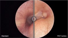 PIET医用图像增强技