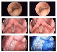 PIET医学图像诊断技