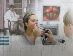 电子硬管喉镜检查