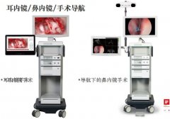 耳内镜/鼻内镜/手术导航系统