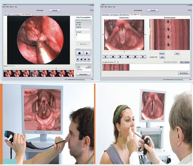 动态电子鼻咽喉镜的临床意义