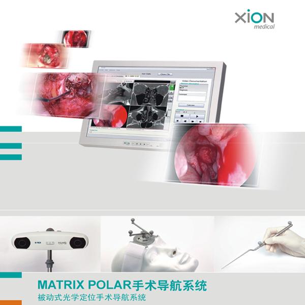 德国XION手术导航系统特点