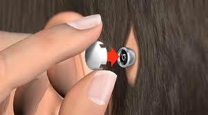 最新的BAHA骨导植入体